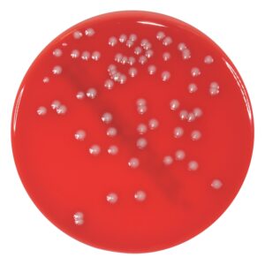 Sheep Blood Agar Plate