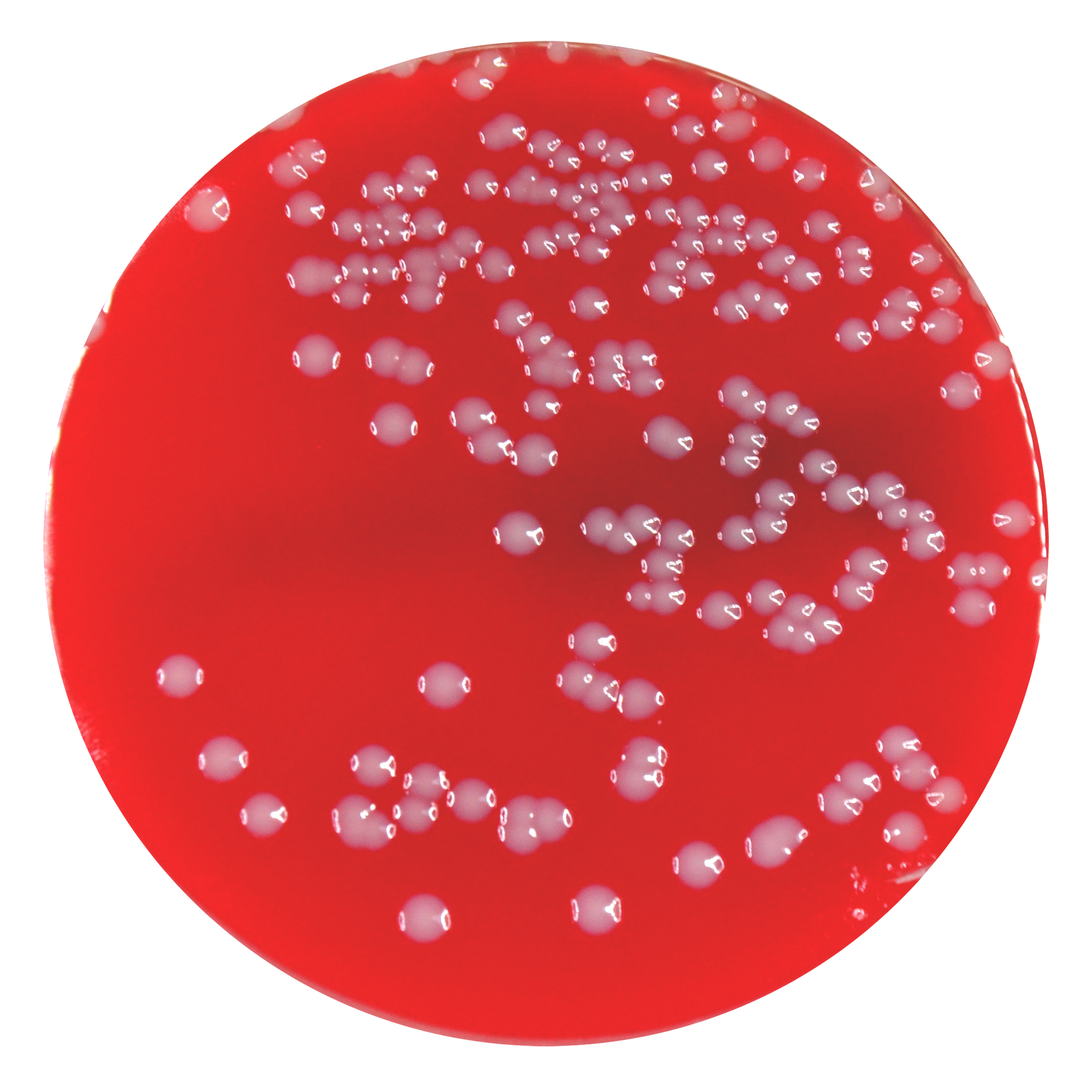 PRM073 Scheep Blood Agar Plate-Staphylococcus aureus ATCC25923