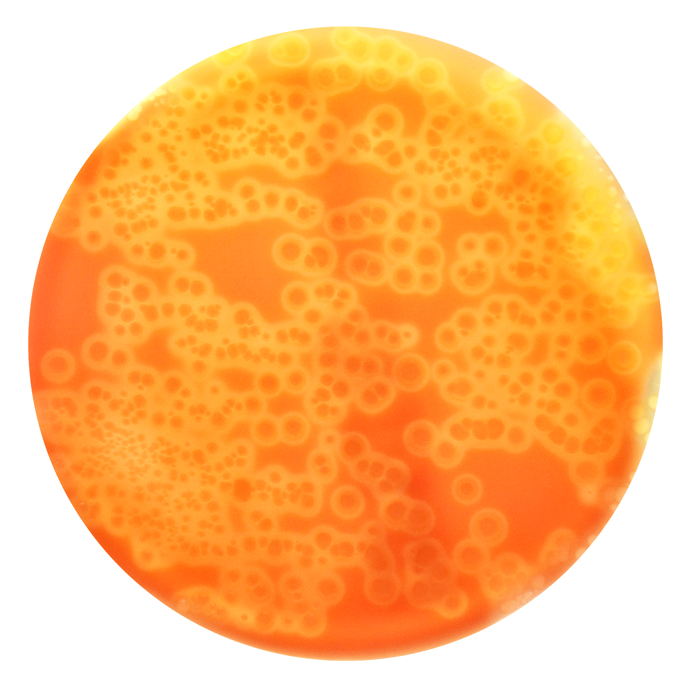 PRM073 Scheep Blood Agar Plate-Streptococcus pyogenes ATCC 1965
