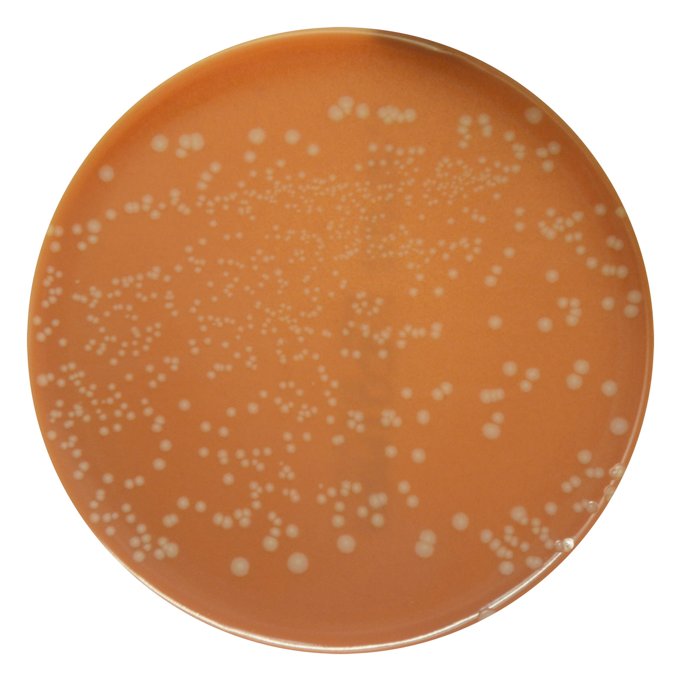 PRM103 Chocolate Agar Plate-Haemophilus influenzae ATCC 49766 PRM103 Chocolate Agar Plate-Haemophilus influenzae ATCC 49766