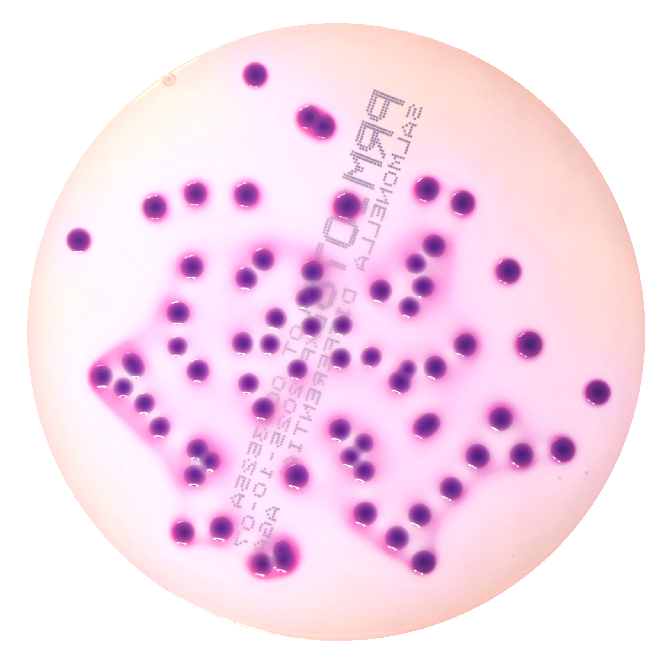 PRM1078 Salmonella Differential Agar Plate RajHans - Klebsiella pneumonia ATCC 13883