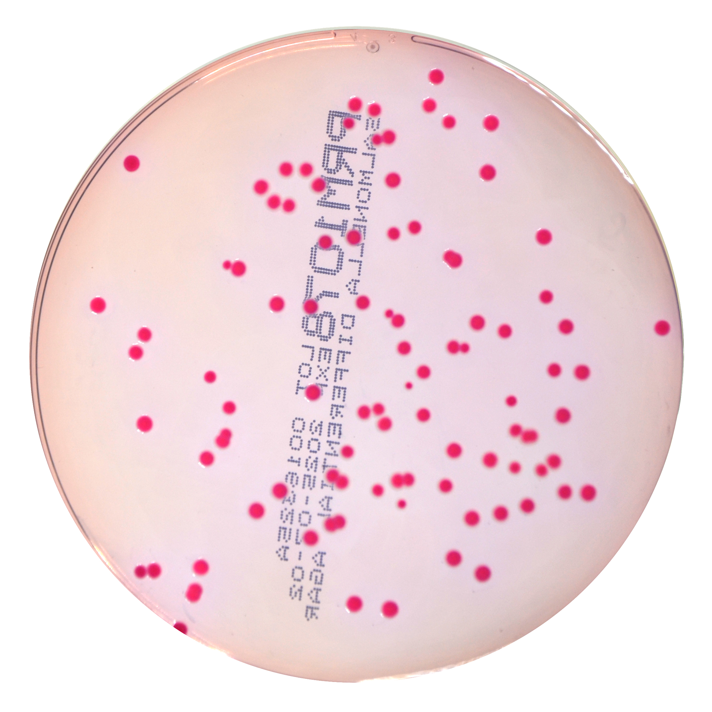 PRM1078 Salmonella Differential Agar Plate RajHans--Salmonella Enteritidis ATCC 13076
