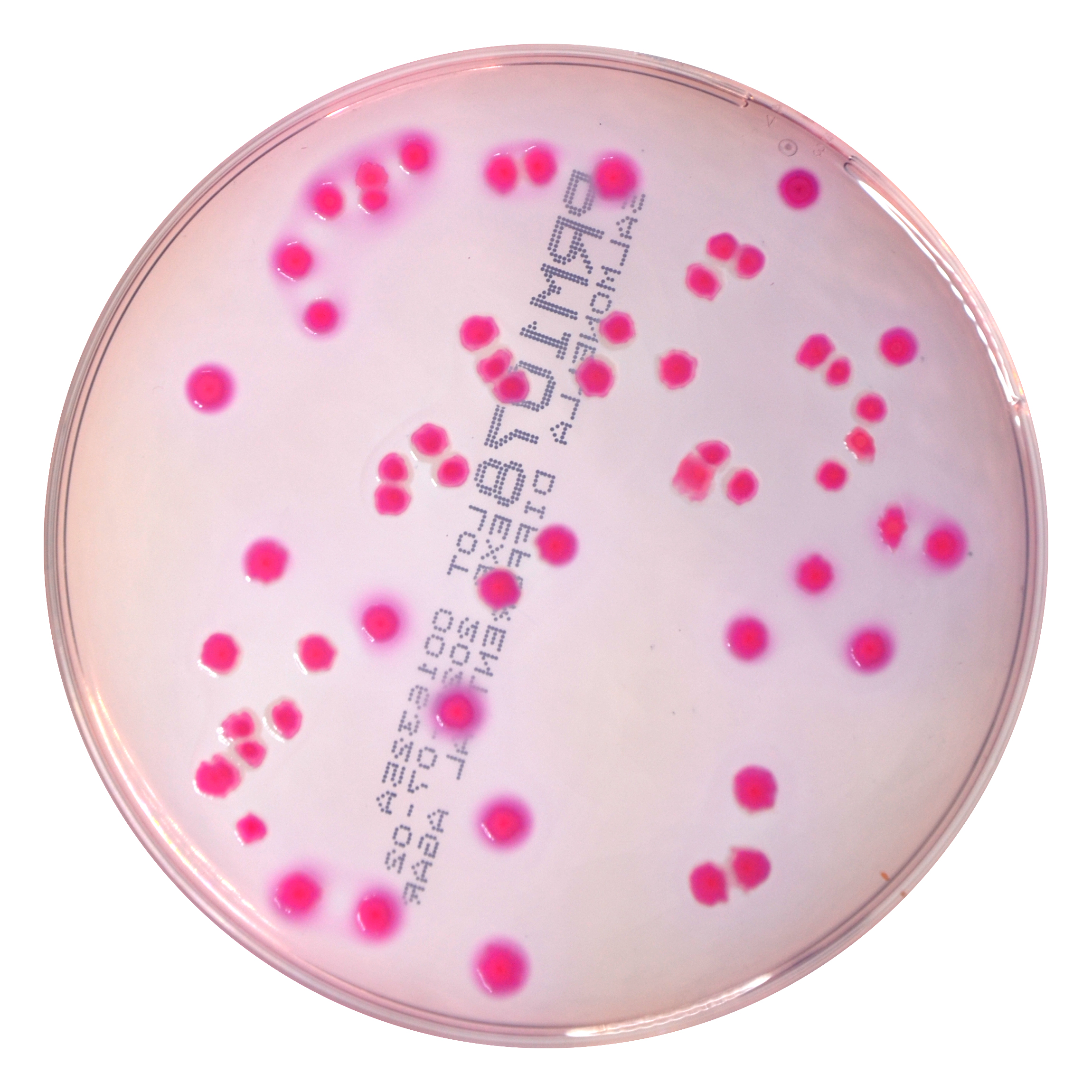 PRM1078 Salmonella Differential Agar Plate RajHans- -Salmonella Typhimurium ATCC 14028