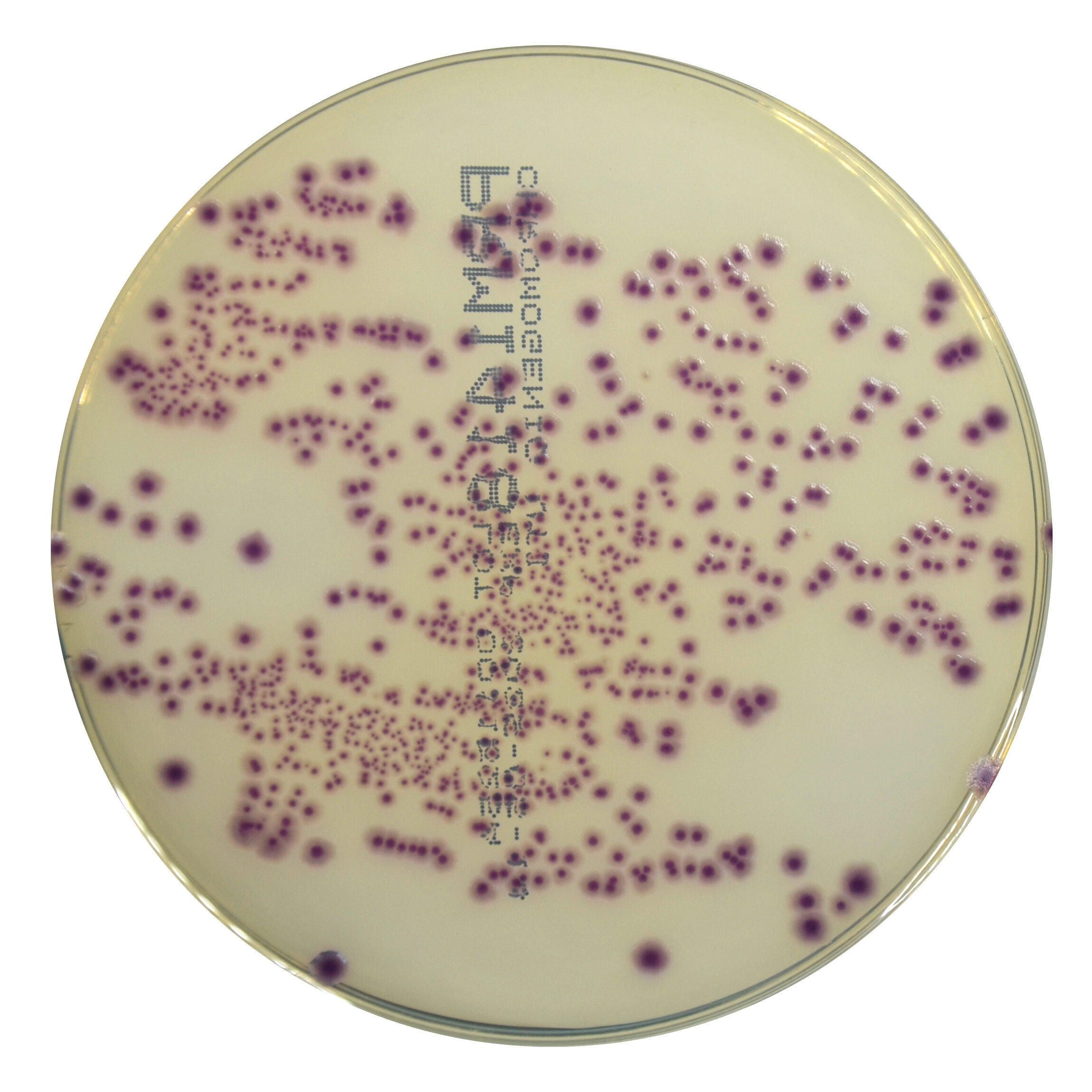 PRM1418 Chromogenic UTI Agar Plate-Escherichia coli ATCC 25922