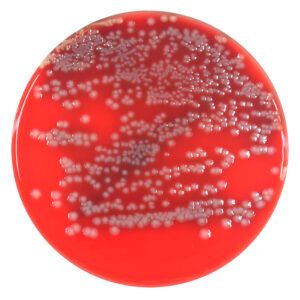 PRM144B Columbia Sheep Blood Agar plate -Escherichia coli ATCC 25922