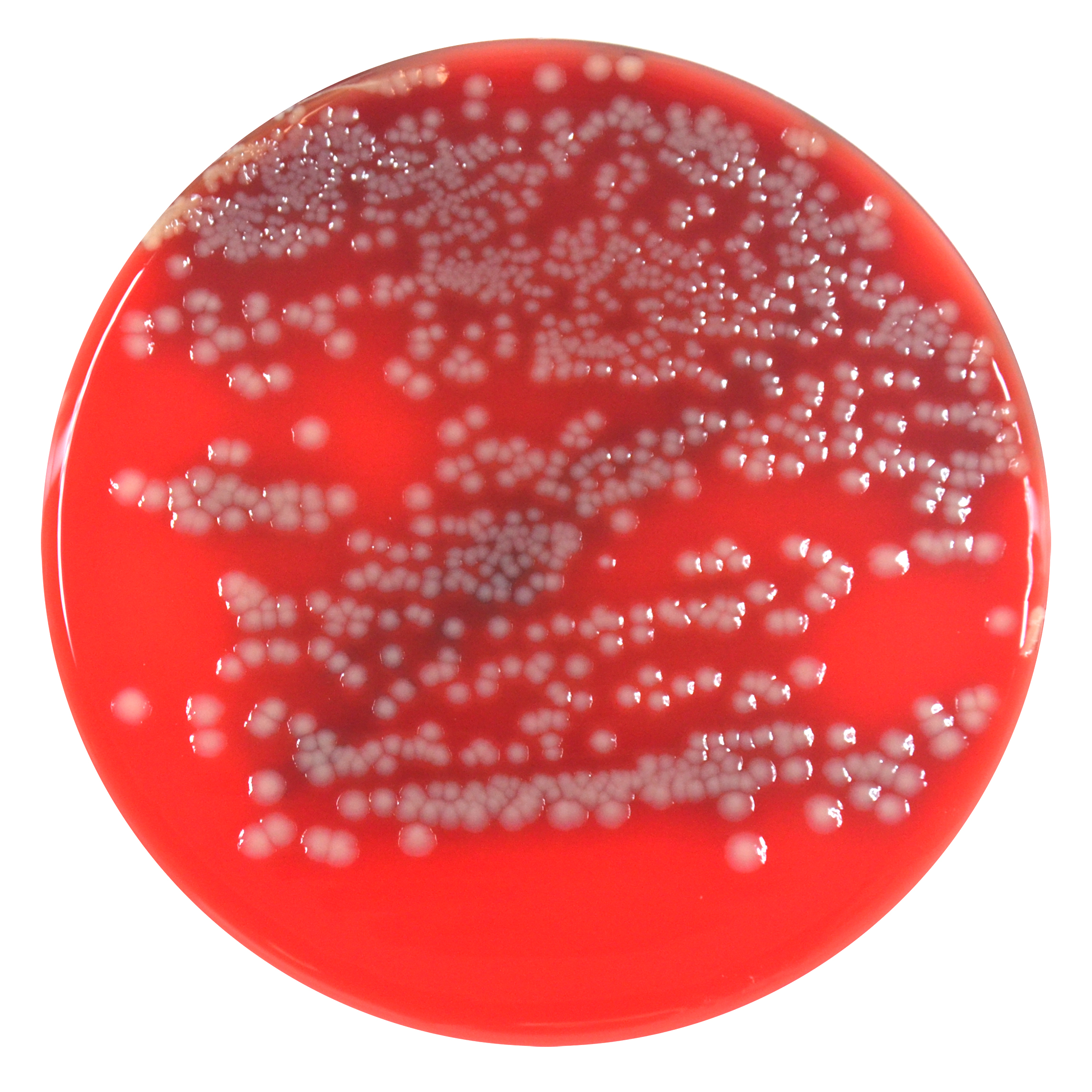 PRM144B Columbia Sheep Blood Agar plate -Escherichia coli ATCC 25922