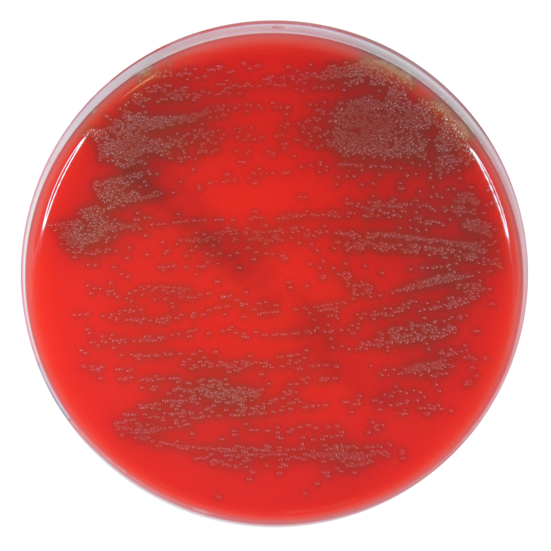 PRM144B Columbia Sheep Blood Agar plate - Streptococcus pneumoniae ATCC 6305